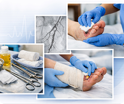 Chronic Wound Types Managed
