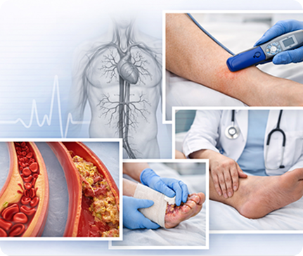 Vascular and Circulatory Support